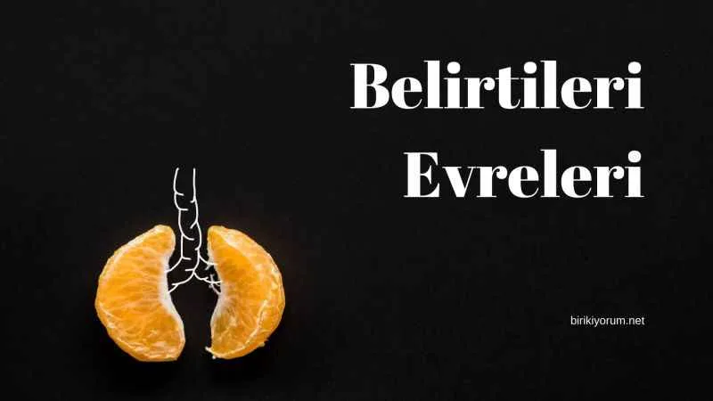 Akciğer Kanseri: Belirtileri ve Evreleri
